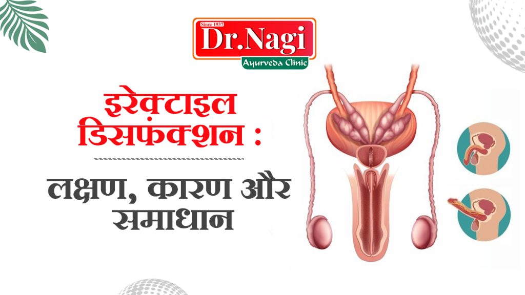 इरेक्टाइल डिसफंक्शन