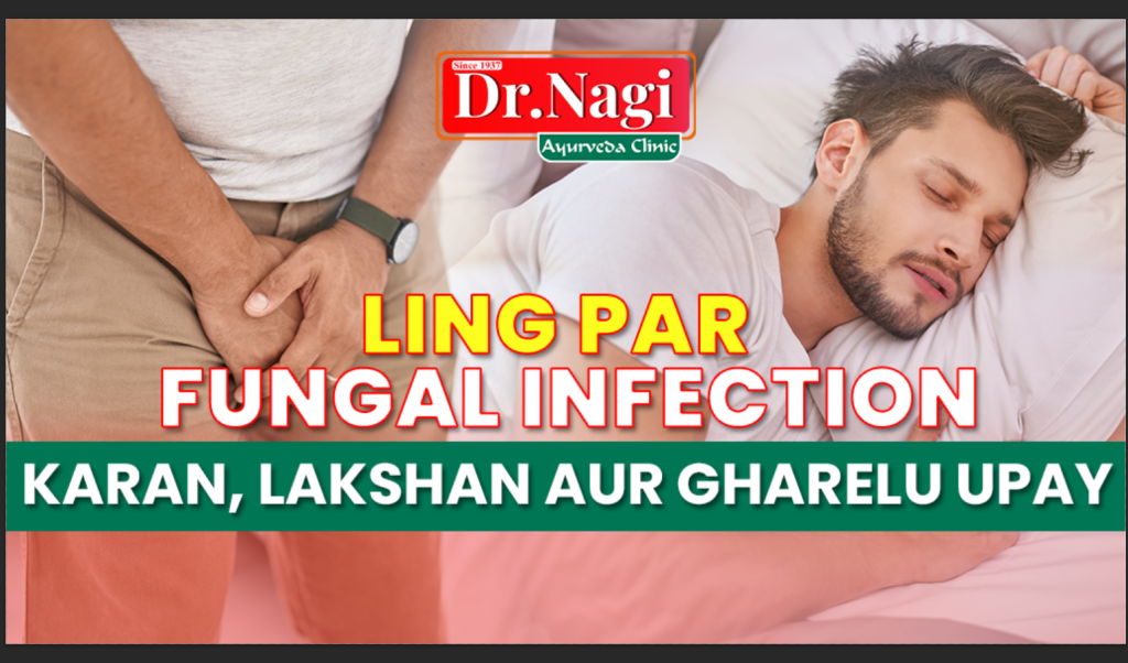 Ling par fungal infection: Karan, Lakshan aur Gharelu Upay