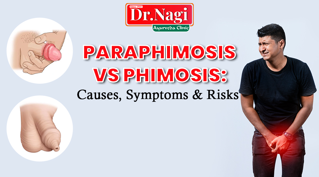 Paraphimosis vs Phimosis