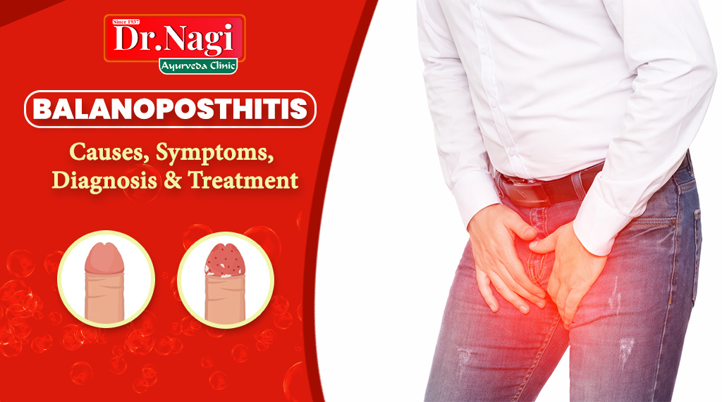Balanoposthitis: Causes, Symptoms, Diagnosis & Treatment