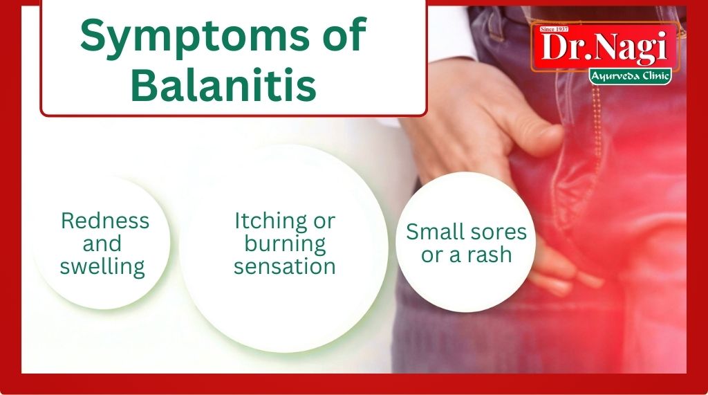 Symptoms of Balanitis
