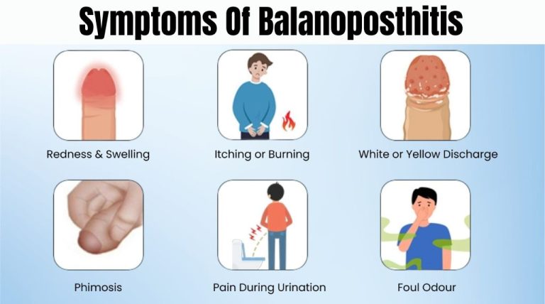 Balanoposthitis: Causes, Symptoms, Diagnosis & Treatment
