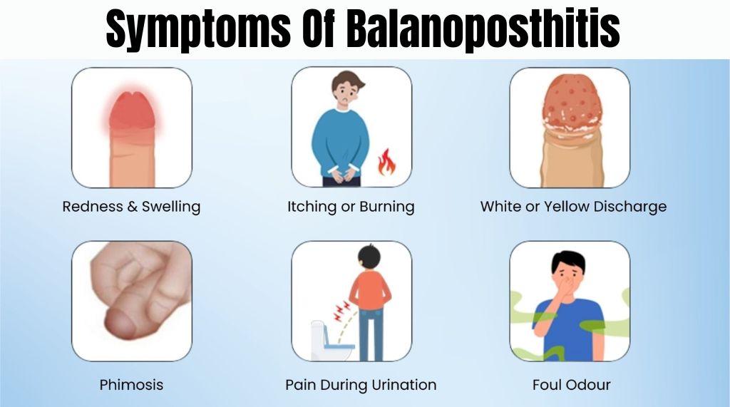 Symptoms of Balanoposthitis